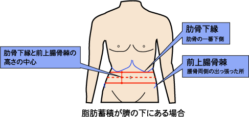 脂肪蓄積がへその下に偏位している場合